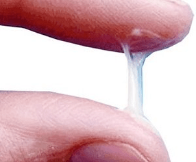 Як у норме выглядаюць мужчынскія вылучэнні